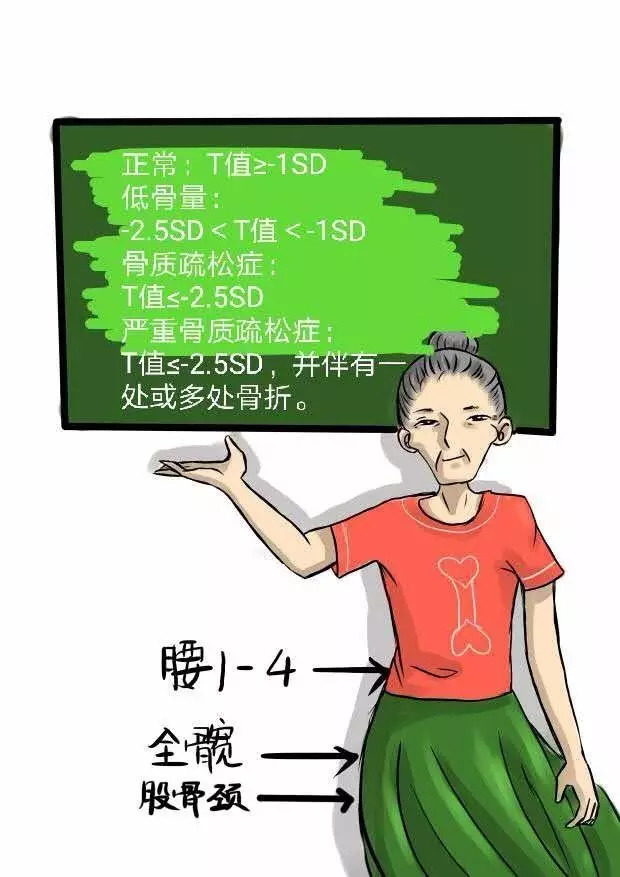 健骨科普讲堂:了解骨质疏松症诊断标准